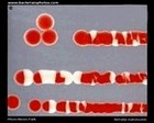 serratia and red pigment prodigiosin